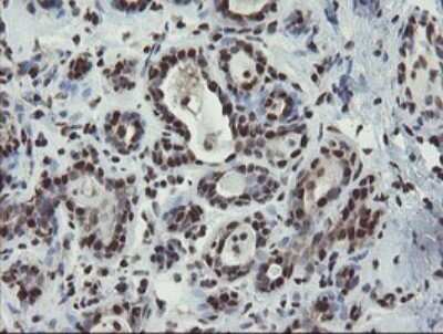 Immunohistochemistry: Mannose Phosphate Isomerase Antibody (OTI4G7) [NBP2-45834]
