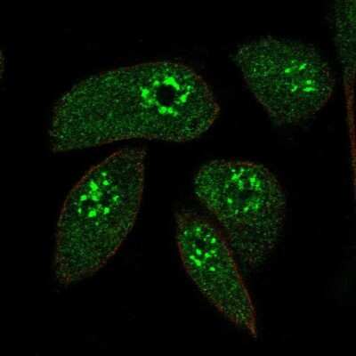 Immunocytochemistry/ Immunofluorescence: Map17 Antibody [NBP1-84290]