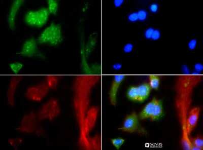 Immunocytochemistry/ Immunofluorescence: Mas Antibody - BSA Free [NBP1-78444]