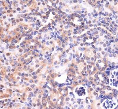 Immunohistochemistry: Mas Antibody - BSA Free [NBP1-78444]