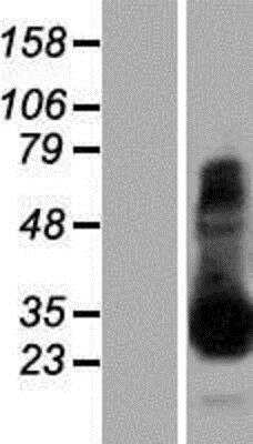 Western Blot: Tryptase alpha/beta 1 Overexpression Lysate [NBP2-08022]