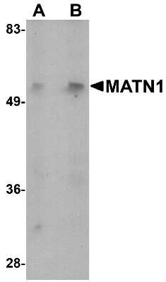 Western Blot: Matrilin-1 AntibodyBSA Free [NBP1-76325]