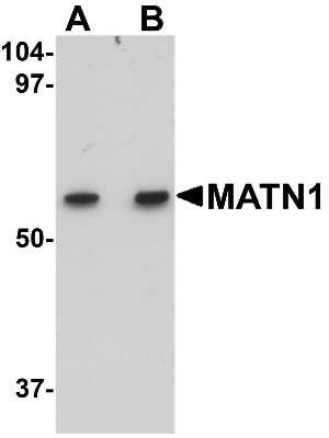 Western Blot: Matrilin-1 AntibodyBSA Free [NBP1-77350]