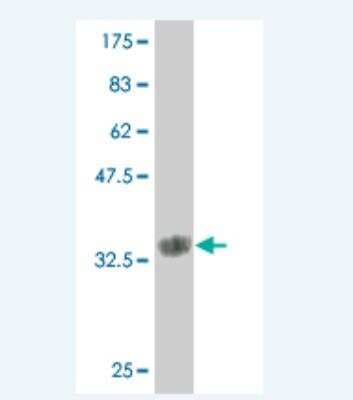 Western Blot: Matrilin-2 Antibody (2B8) [H00004147-M01]