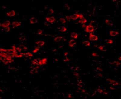 Immunocytochemistry/ Immunofluorescence: Matrilin-4 Antibody - BSA Free [NBP1-77012]