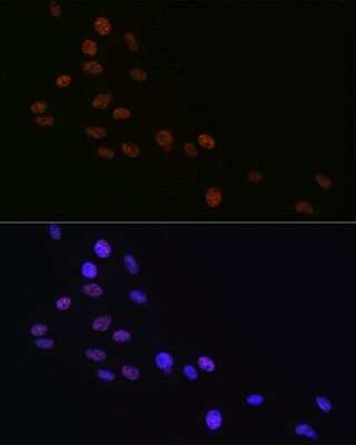 Immunocytochemistry/ Immunofluorescence: Matrin 3 Antibody (10O1D1) [NBP3-15307]