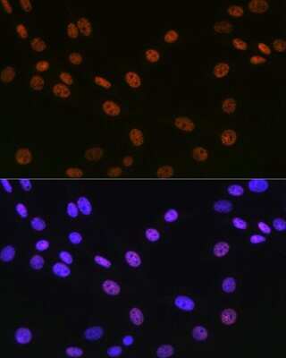 Immunocytochemistry/ Immunofluorescence: Matrin 3 Antibody (10O1D1) [NBP3-15307]