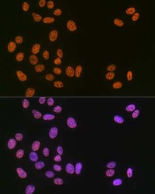 Immunocytochemistry/ Immunofluorescence: Matrin 3 Antibody (10O1D1) [NBP3-15307]