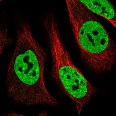 Immunocytochemistry/ Immunofluorescence: Matrin 3 Antibody [NBP1-87859]