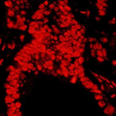 Immunohistochemistry: Matrin 3 Antibody [NB100-1761]