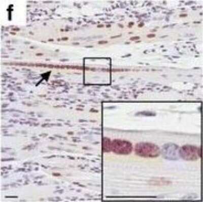 Immunohistochemistry: Matrin 3 Antibody [NB100-1761]