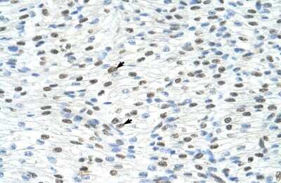 Immunohistochemistry: Matrin 3 Antibody [NBP1-57359]