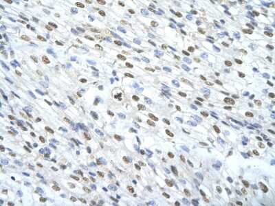 Immunohistochemistry: Matrin 3 Antibody [NBP1-57359]
