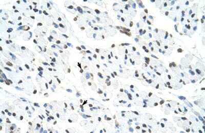 Immunohistochemistry-Paraffin: Matrin 3 Antibody [NBP1-57359]