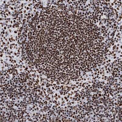 Immunohistochemistry-Paraffin: Matrin 3 Antibody [NBP1-87859]