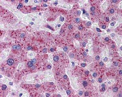 Immunohistochemistry-Paraffin: Matriptase 2 Antibody [NBP1-57098]