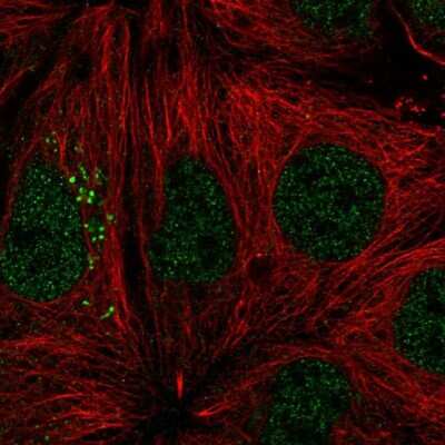 Immunocytochemistry/ Immunofluorescence: Matriptase/ST14 Antibody [NBP3-05520]