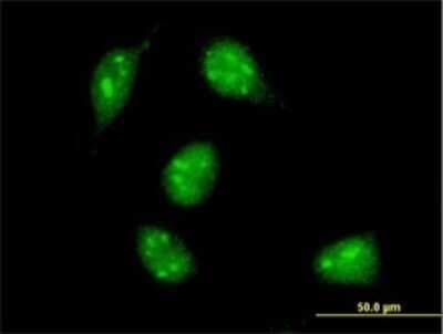 Immunocytochemistry/ Immunofluorescence: Max Antibody (4E10-1A9) [H00004149-M01]