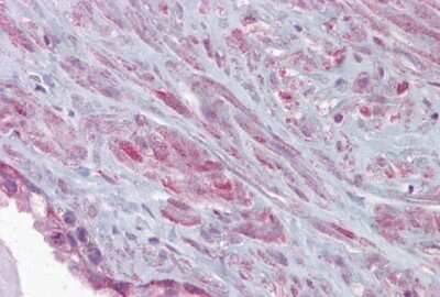 Immunohistochemistry: Maxi Potassium channel alpha Antibody [NBP2-87781]