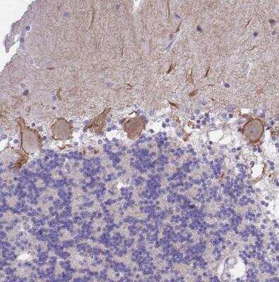 Immunohistochemistry-Paraffin: Maxi Potassium channel alpha Antibody [NBP2-33726]