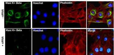 Immunocytochemistry/ Immunofluorescence: Maxi Potassium channel beta Antibody [NB300-535]