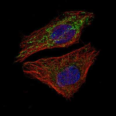 Immunocytochemistry/ Immunofluorescence: Mcl-1 Antibody (CL1128) [NBP2-52968]