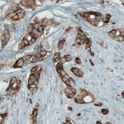 Immunohistochemistry-Paraffin: Mcl-1 Antibody (CL1128) [NBP2-52968]
