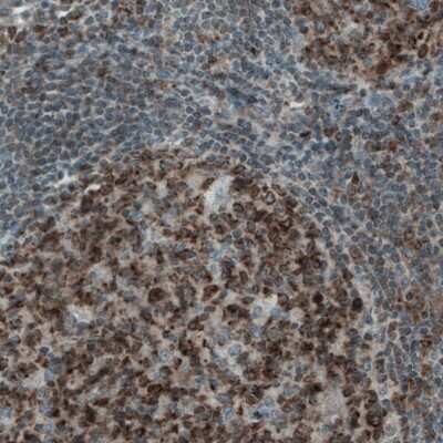 Immunohistochemistry-Paraffin: Mcl-1 Antibody (CL1128) [NBP2-52968]