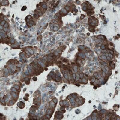 Immunohistochemistry-Paraffin: Mcl-1 Antibody (CL1128) [NBP2-52968]