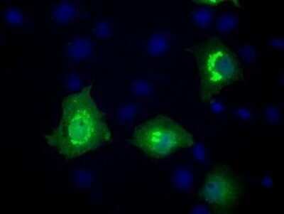 Immunofluorescence: Mcl-1 Antibody (OTI10F6) [NBP2-45773]