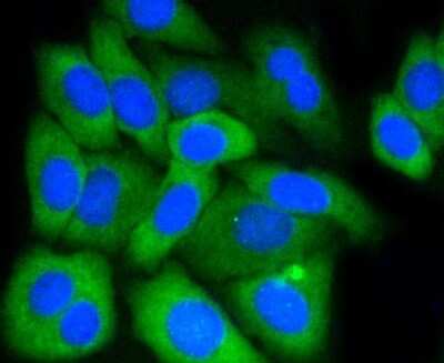 Immunocytochemistry/ Immunofluorescence: Mcl-1 Antibody (SI16-04) [NBP2-67400]