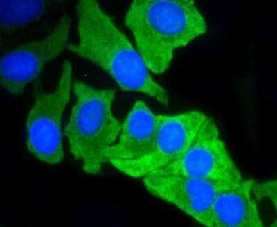 Immunocytochemistry/ Immunofluorescence: Mcl-1 Antibody (SI16-04) [NBP2-67400]