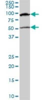 Western Blot: MeCP2 Antibody (4B6) [H00004204-M01]