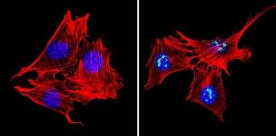 Immunocytochemistry/ Immunofluorescence: MeCP2 Antibody [NB600-1101]