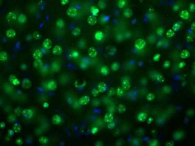 Immunocytochemistry/ Immunofluorescence: MeCP2 Antibody [NBP2-50060]