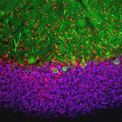 Immunohistochemistry Free-Floating: MeCP2 Antibody [NBP2-50060]