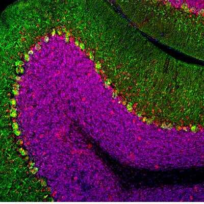 Immunocytochemistry/ Immunofluorescence: MeCP2 Antibody [NBP3-05541]