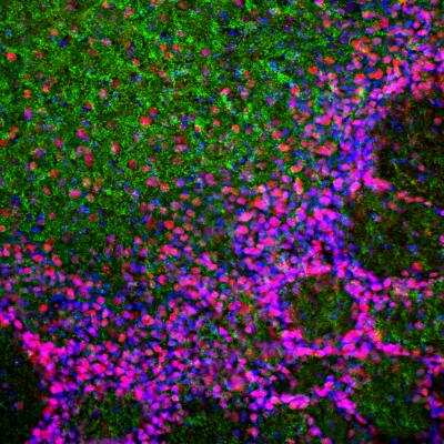 Immunocytochemistry/ Immunofluorescence: MeCP2 Antibody [NBP3-05542]