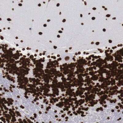 Immunohistochemistry-Paraffin: MeCP2 Antibody [NBP1-81027]