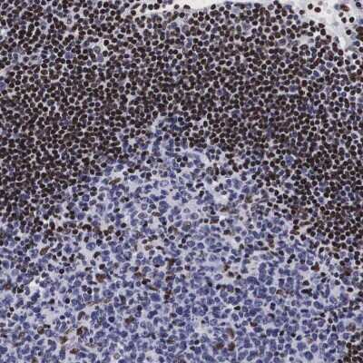 Immunohistochemistry-Paraffin: MeCP2 Antibody [NBP1-81027]