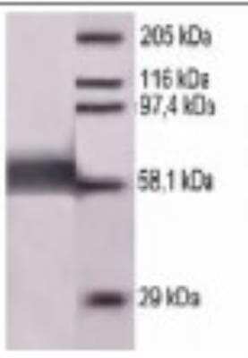 Western Blot: Measles nucleoprotein Antibody [NBP2-42701]
