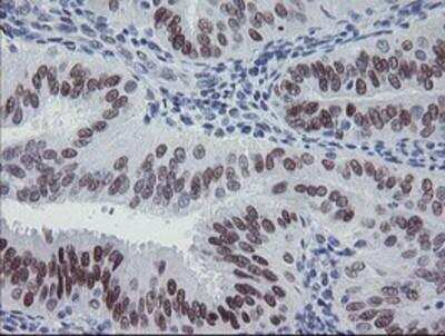 Immunohistochemistry-Paraffin: Meis homeobox 3 Antibody (OTI3E12) [NBP2-03933]