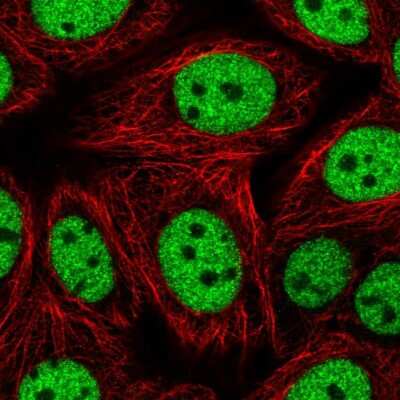 Immunocytochemistry/ Immunofluorescence: Meis homeobox 3 Antibody [NBP2-14230]