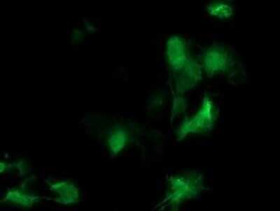 Immunocytochemistry/ Immunofluorescence: Meis homeobox 3 Antibody (OTI3A7) [NBP2-45813]