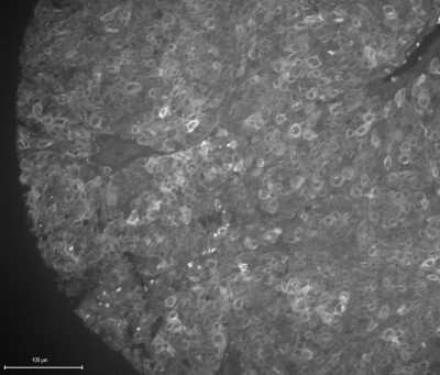 Immunohistochemistry-Paraffin: Melan-A/MART-1 Antibody (A103 + M2-7C10 + M2-9E3) - Azide and BSA Free [NBP2-34546]