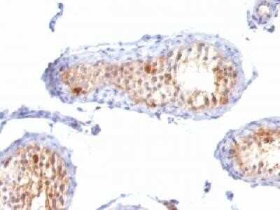Immunohistochemistry-Paraffin: Melan-A/MART-1 Antibody (A103 + M2-7C10 + M2-9E3) - Azide and BSA Free [NBP2-34546]