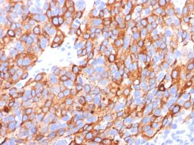 Immunohistochemistry-Paraffin: Melan-A/MART-1 Antibody (A103 + M2-7C10 + M2-9E3) [NBP2-34244]