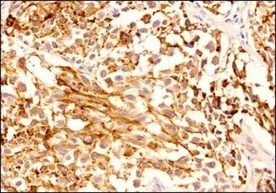 Immunohistochemistry-Paraffin: Melan-A/MART-1 Antibody (A103) - Azide and BSA Free [NBP2-80846]