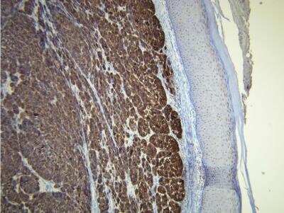 Immunohistochemistry-Paraffin: Melan-A/MART-1 Antibody (A19-P) [NBP1-30151]