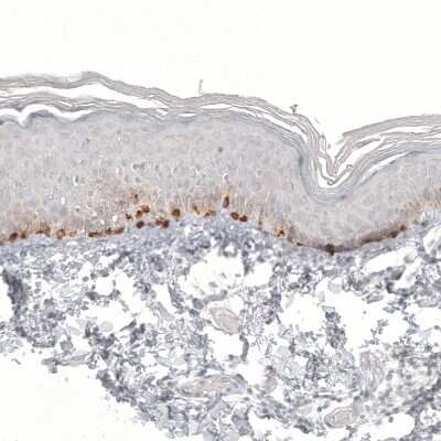 Immunohistochemistry-Paraffin: Melan-A/MART-1 Antibody (CL12863) [NBP3-18576]